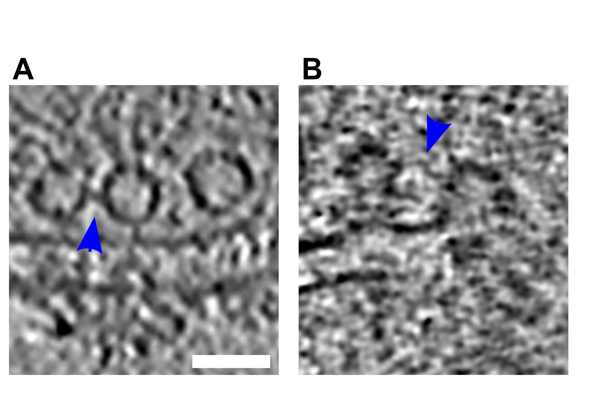 Figure S4: (A, B) Tomographic slices showing tethered connected vesicles. Blue arrows highlight the connectors. Scale bar, 50 nm.