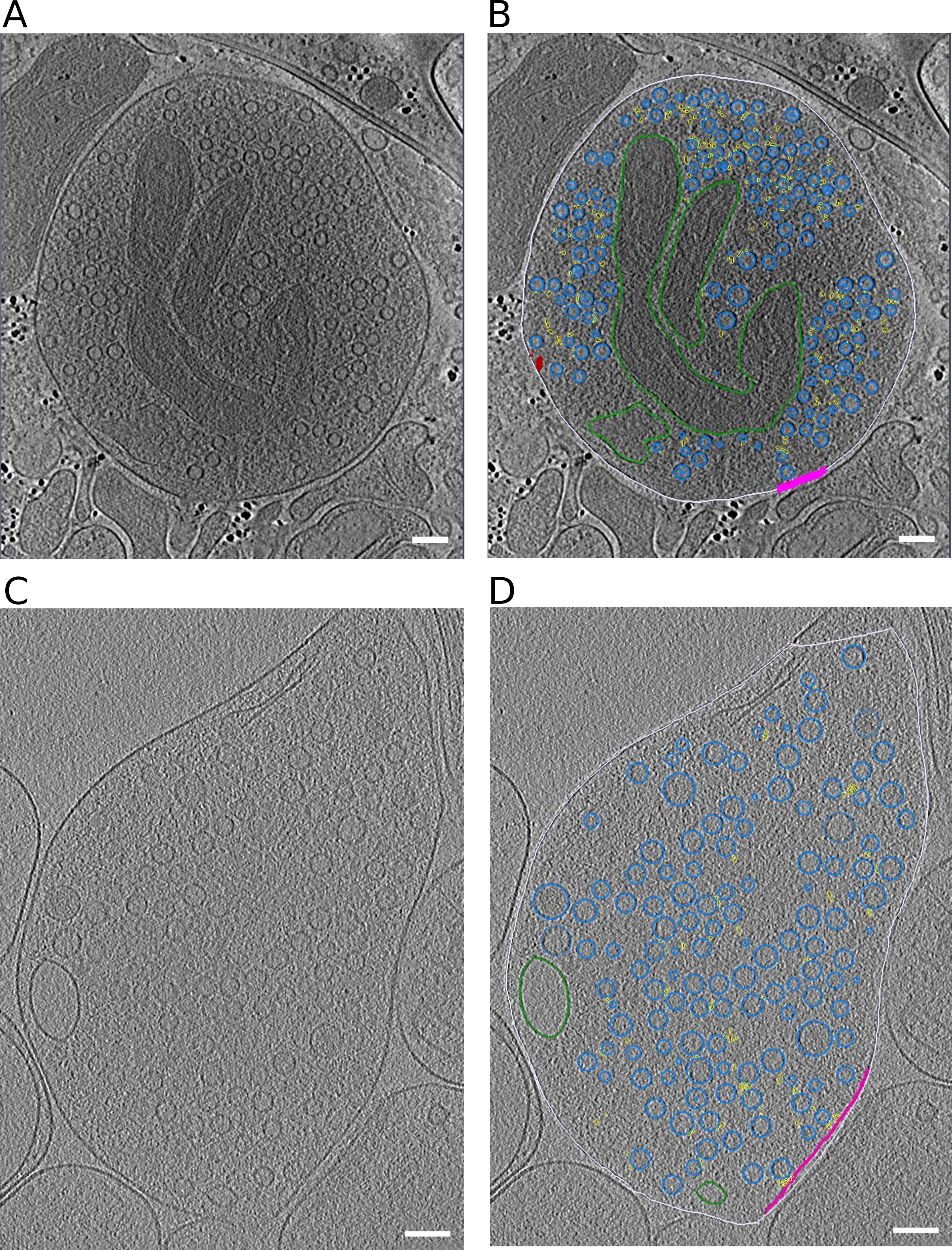 Figure S1: Representative slices through tomograms. (A, B) Tomographic slice without (A) and with (B) segmentation of synaptosome with late fusion events. (C,D) Tomographic slice without (C) and with (D) segmentation of WT SNAP-25 neurons. Segmentation colors: off-white = cell outline; pink = active zone; blue = synaptic vesicles; green = mitochondria; yellow = connectors, red = tethers. Scale bar, 100 nm.